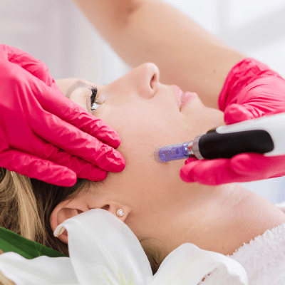 Microneedling